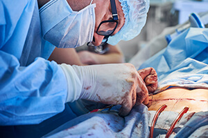 Когда рассасываются швы?