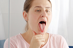 Белый налет на языке