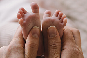 Косолапость