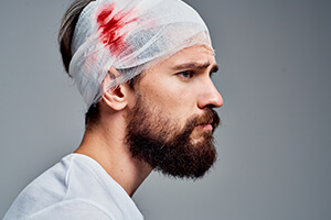 Сотрясение мозга