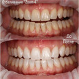 Стоматология Здоровые зубы, фото №4