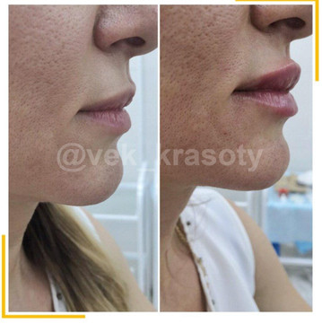 Век красоты на Кати Зеленко, фото №1