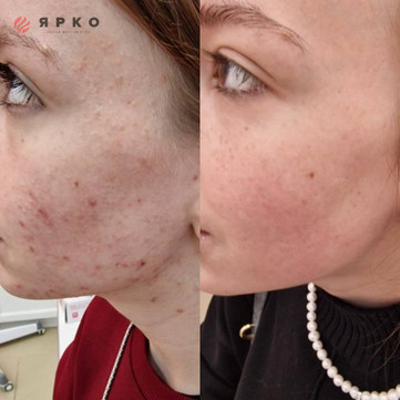 Косметология Ярко, фото №1