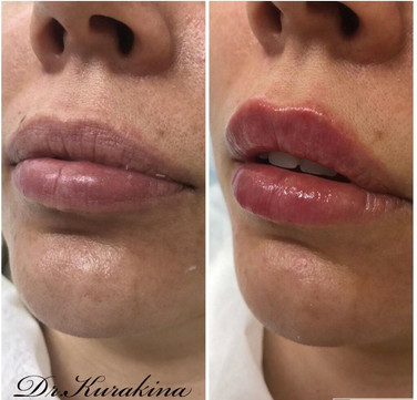 Гармония на Дуси Ковальчук, фото №1