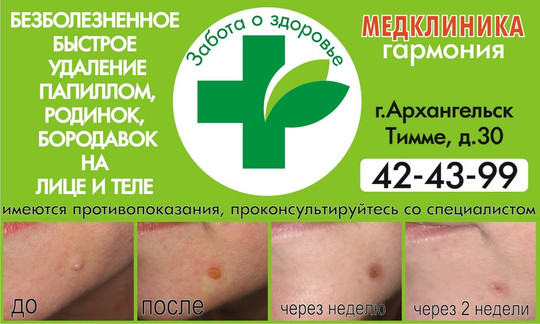 Гармония на Тимме Я., фото №1