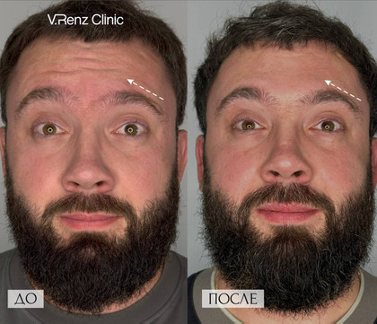 Косметология V.Renz Clinic, фото №1