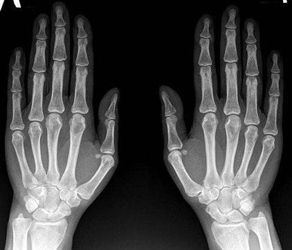 Пикассо на Ленинградском, фото №1