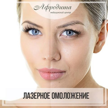 Афродита на 5 Армии, фото №1