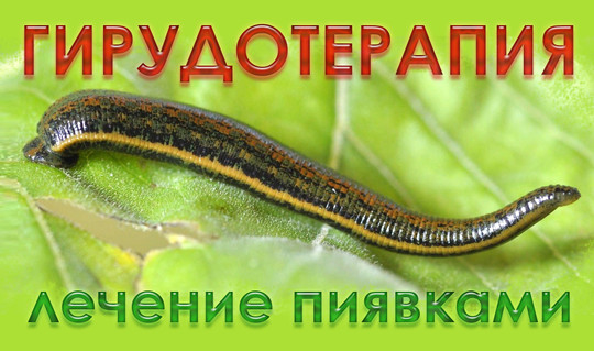 Здоровье нации, фото №1