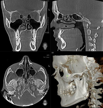 Пикассо на Ленинградском, фото №1