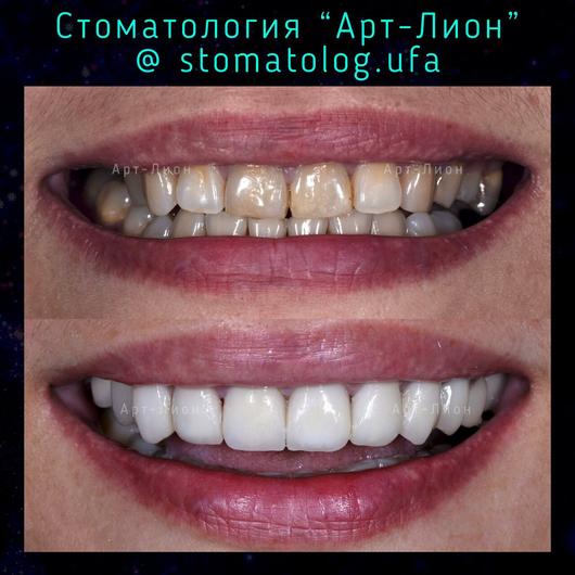 Стоматология «Арт-Лион» на Энтузиастов, фото №1