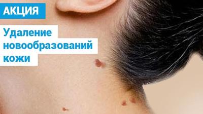 Фото акции