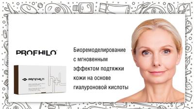 Фото акции