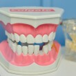 6 мифов о здоровье зубов