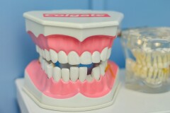 6 мифов о здоровье зубов