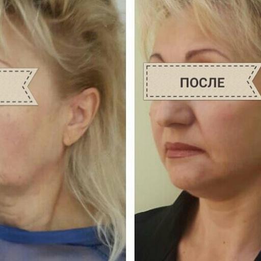 где сделать обрезание ребенку в нальчике. Смотреть фото где сделать обрезание ребенку в нальчике. Смотреть картинку где сделать обрезание ребенку в нальчике. Картинка про где сделать обрезание ребенку в нальчике. Фото где сделать обрезание ребенку в нальчике