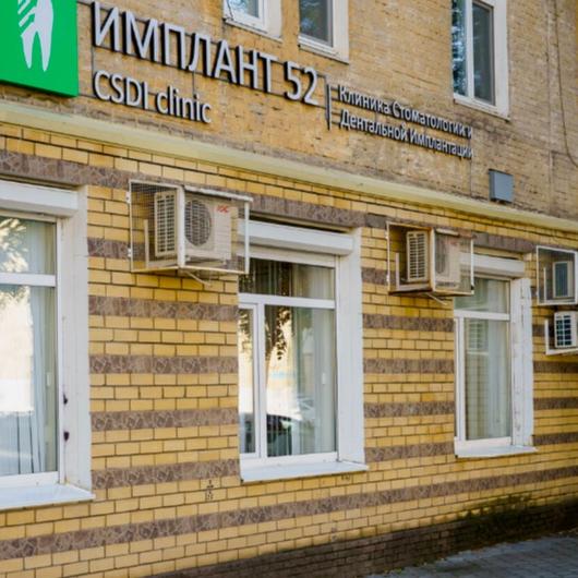 Имплант52 CSDI clinic на Революции, фото №1