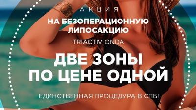 Фото акции