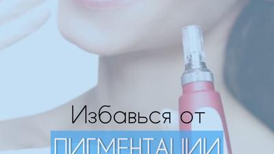 Фото акции