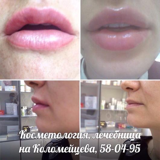 Косметология на Коломейцева, фото №4