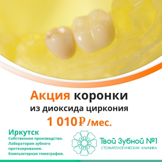 Твой зубной №1 на Иркутской 30 Дивизии, фото №3