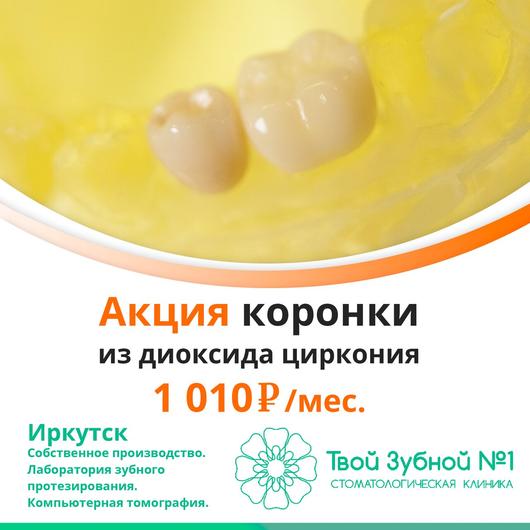 Твой зубной №1 на Иркутской 30 Дивизии, фото №3