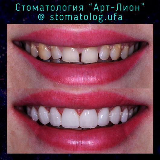 Стоматология «Арт-Лион» на Менделеева, фото №3