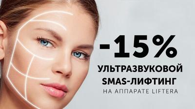 Фото акции