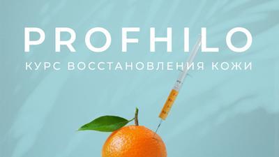 Фото акции