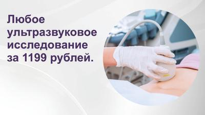 Фото акции