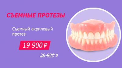 Фото акции