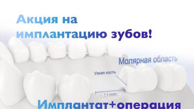Фото акции