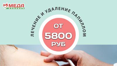 Фото акции