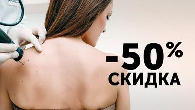 Фото акции