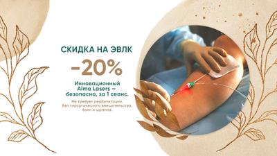 Фото акции