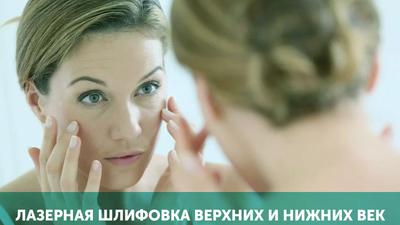 Фото акции