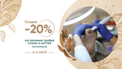 Фото акции