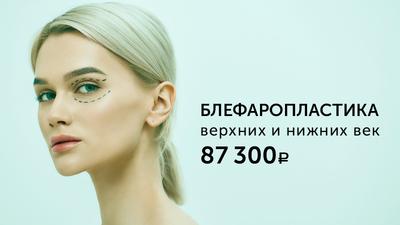 Фото акции